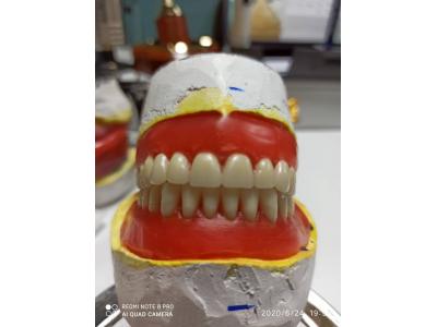اولین مرکز ساخت پروتزهای دندانی مجاز-بهترین  دندانسازی در فردیس کرج